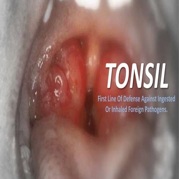Tonsil