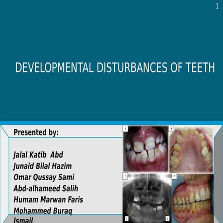 developmental anomalies of teeth | PPT