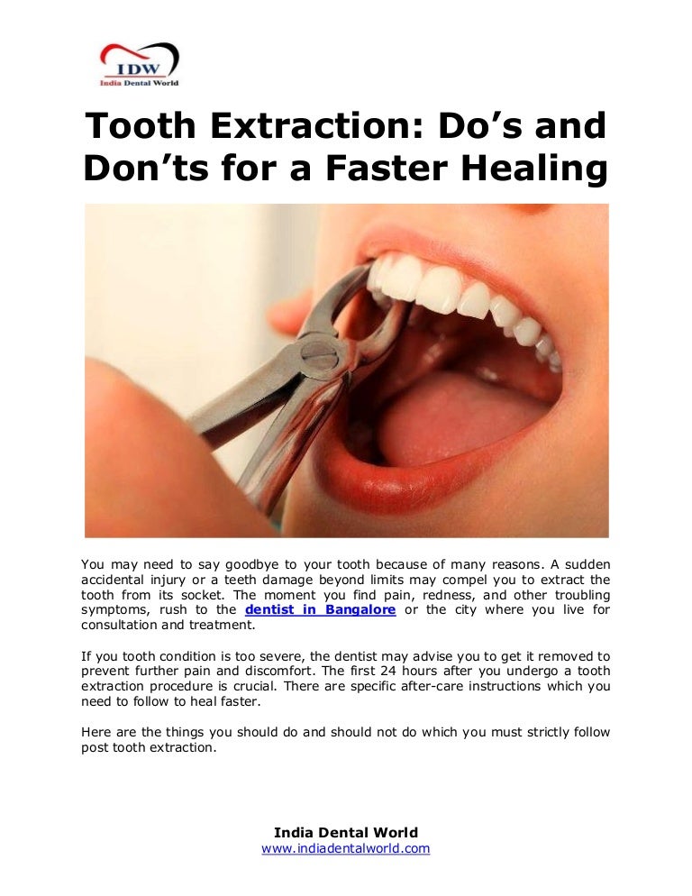 Tooth Extraction Do’s and Don’ts for a Faster Healing