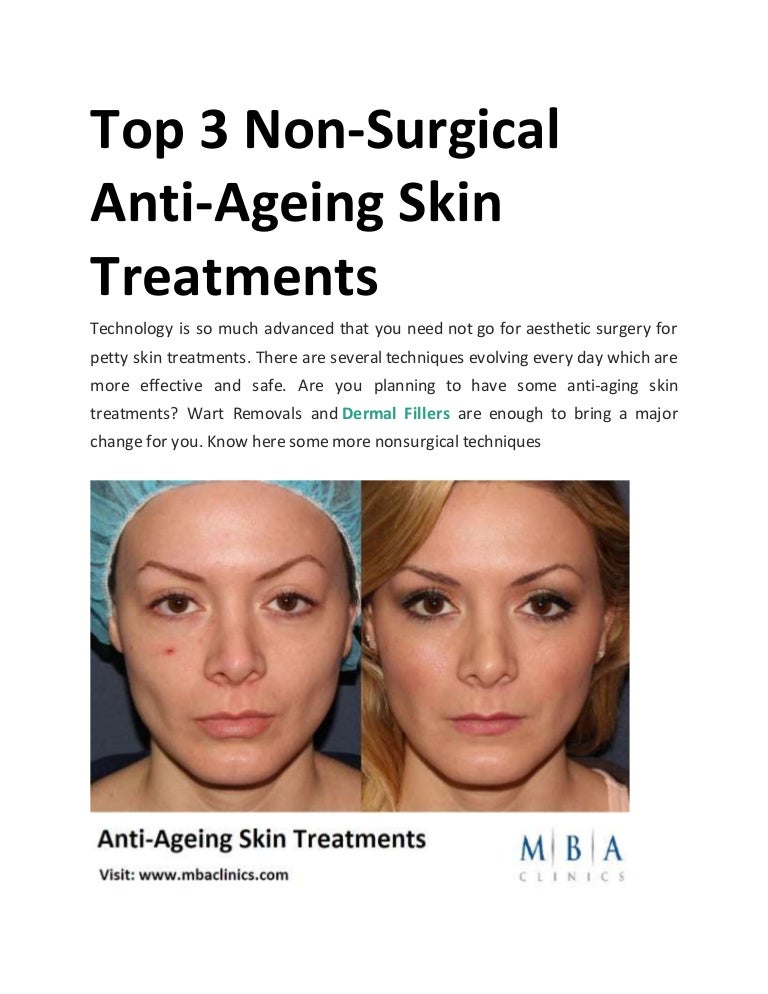 warts on aging skin