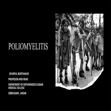 TOPIC -POLIOMYELITIS PRESENTATION ..pptx