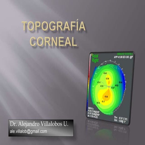 Corneal Topography