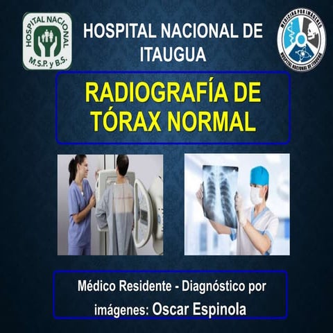 Torax normal-Oscar 2024- principios físicos del rx de torax | PPTX