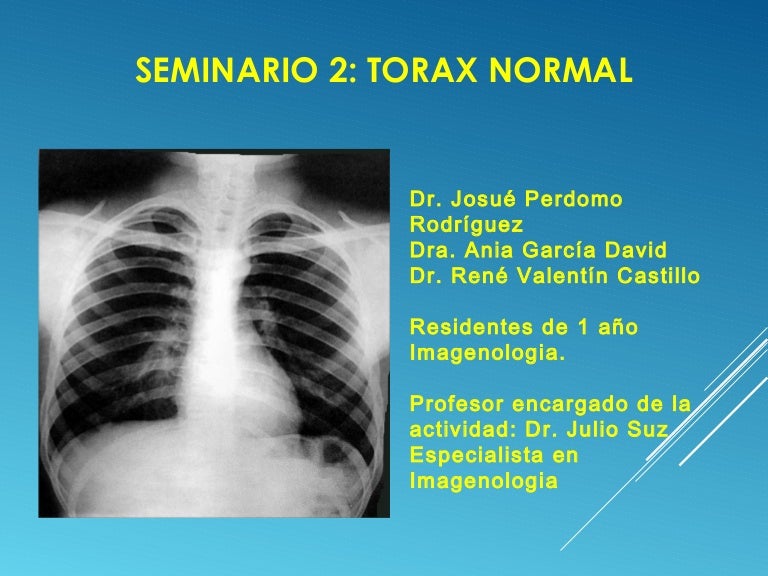 rx torax normal mujer