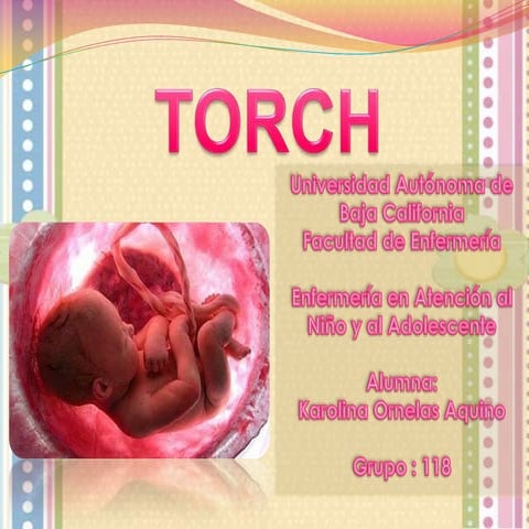 TORCH | PPTX