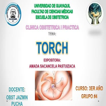 TORCH | PPTX