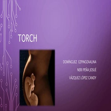 Torch