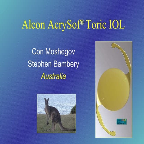 Toric lenses san diego 07