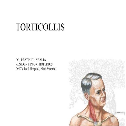 Torticollis
