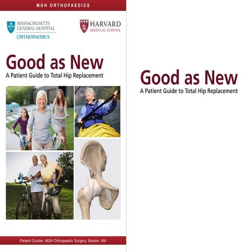 Total hip-replacement-guide