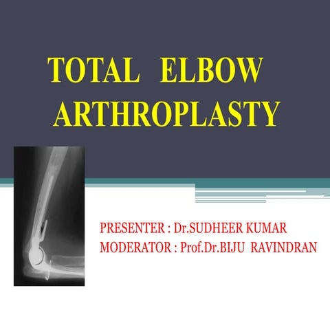 Total elbow arthroplasty