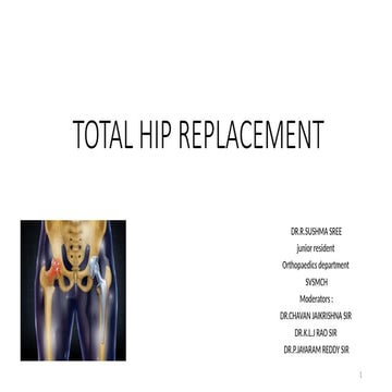An brief summary about tota hip arthroplasty
