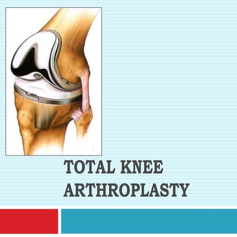 Total knee arthroplasty.pptx
