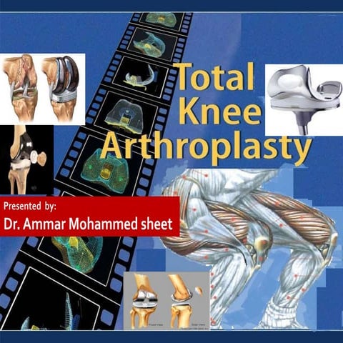 Total knee arthroplasty by dr..ammar m.sheet