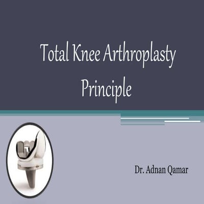 Total Knee Arthroplasty Principle
