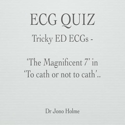 ECG Quiz