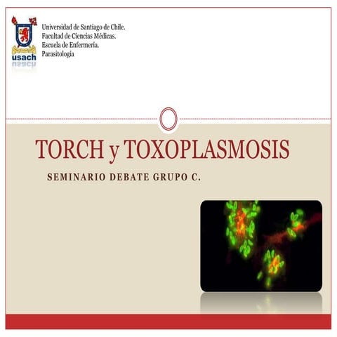Toxoplasmosis