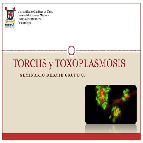 Toxoplasmosis