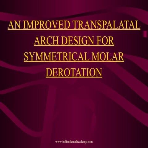 Transpalatal arch design