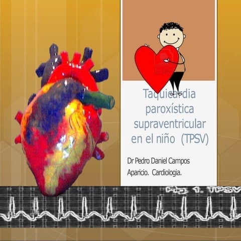 tpsv-Dr Pedro.pptx