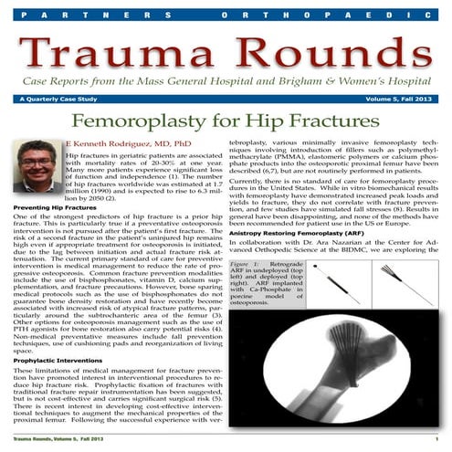 Femoroplasty for Hip Fractures