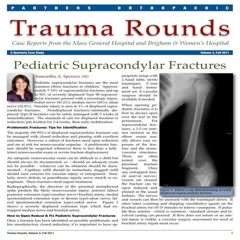 Pediatric Supracondylar Fractures