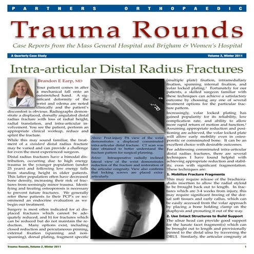 Intra-articular Distal Radius Fractures