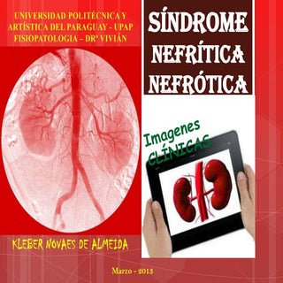 Trabajo síndrome nefrítica y nefrótica