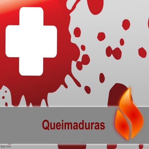 Trabalho sobre Queimaduras
