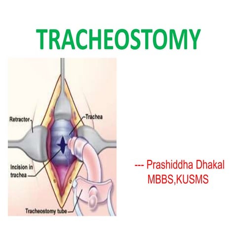 Tracheostomy
