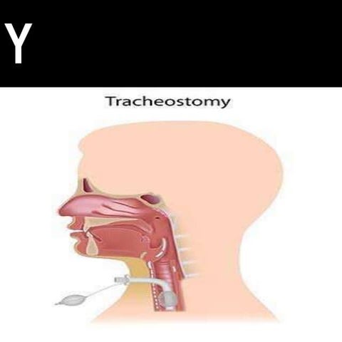 Tracheostomy ( for medical students )