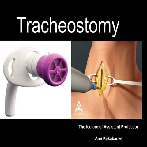 Tracheostomy