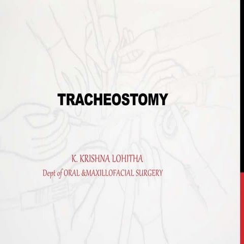 Tracheostomy 