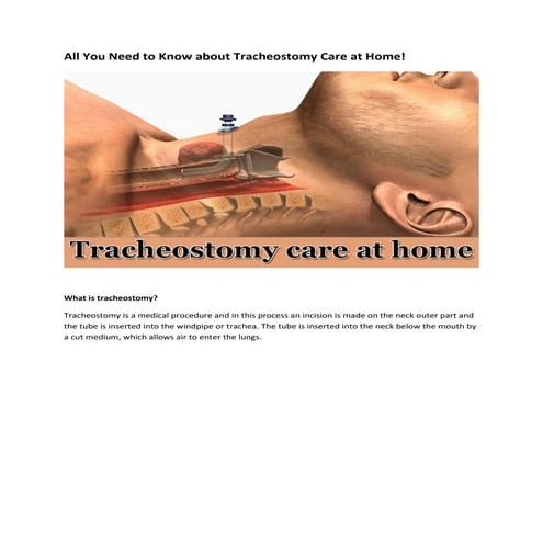 All about Tracheostomy care at home