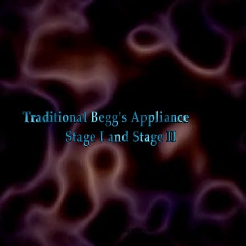 Traditional begg technique stage 1 and stage 2