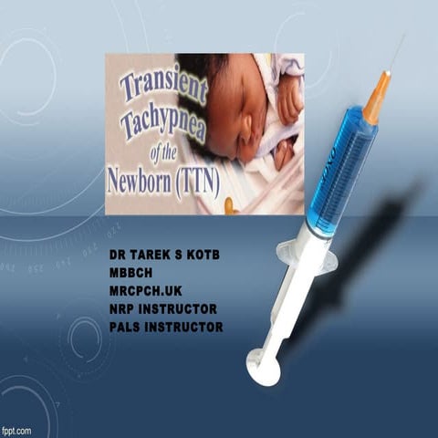 Transient tachypnea of newborn ttn