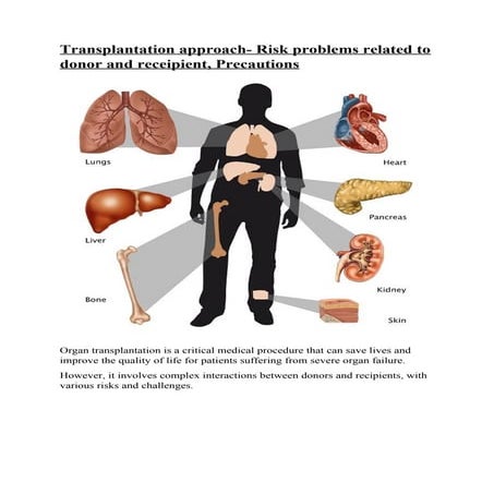 Transplantation approach - organ donation.docx