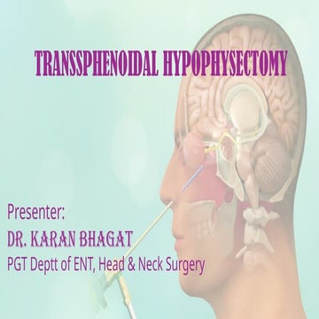 TRANSSPHENOIDAL.pptx by dr Karan Bhagat Pgt | PPTX