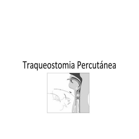 Traqueostomia percutánea