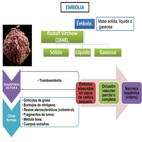 Trastornoshemodinamicos2