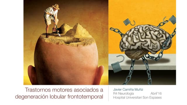 Trastornos motores asociados a demencia frontotemporal. 