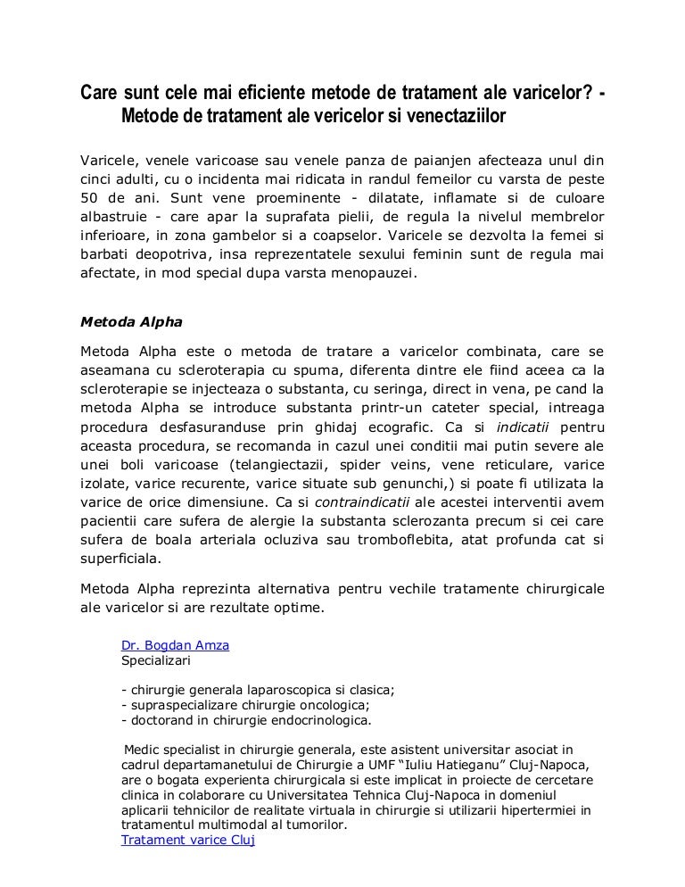 varicoza metode de operaiuni