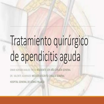 Tratamiento quirúrgico de apendicitis aguda