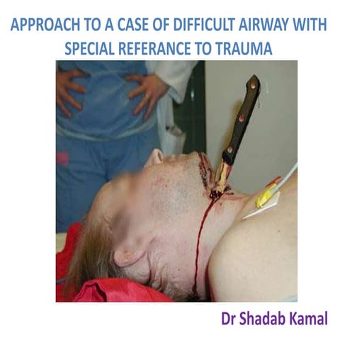 approach to a case of difficult airway with special referance to Trauma