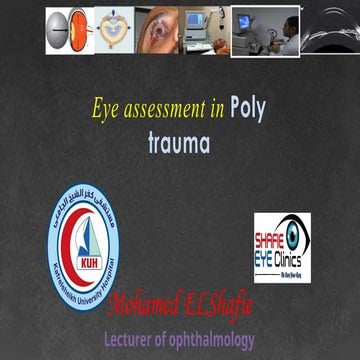 Eye assessment in polytrauma for undergraduates.pptx