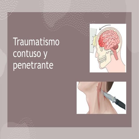 Trauma.pptx traumatismo contuso y penetrante | PPTX