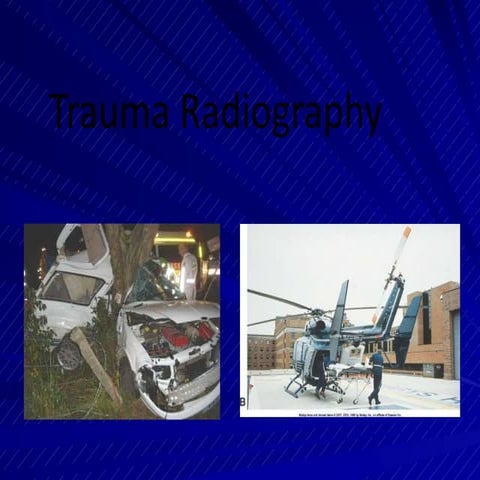 Trauma radiograph