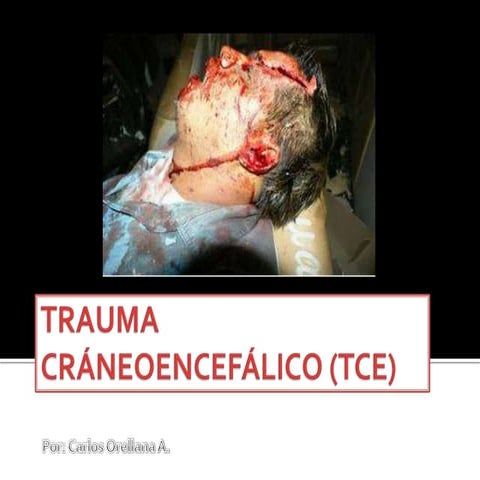 Trauma cráneo encefálico (tce)