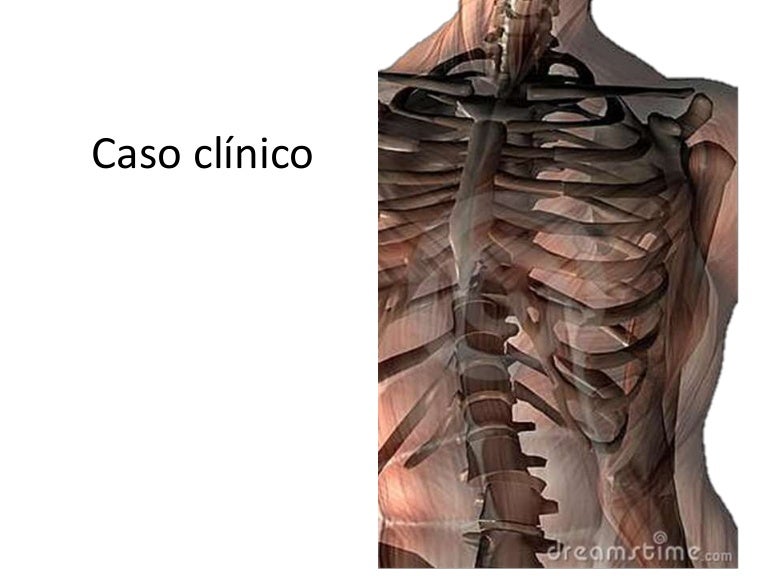 Traumatismo toracico abdominal