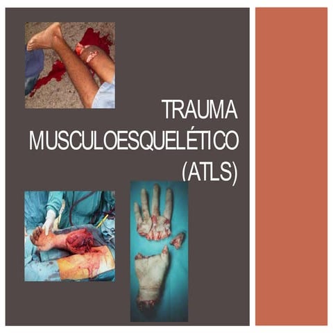 Trauma ortopedia clínica musculoesqueletica